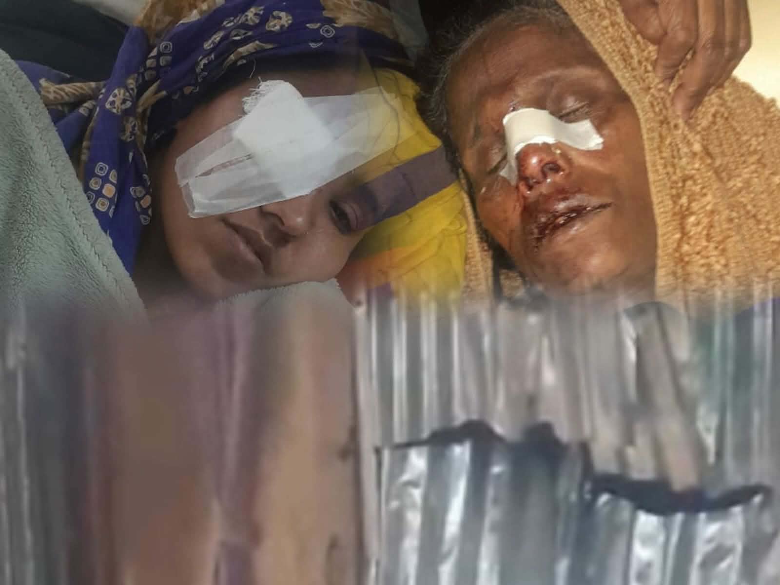 ছাতক-এর বাগারাই গ্রামে প্রতিপক্ষের হামলা,দুই নারীসহ আহত ৬, এলাকায় উত্তেজনা